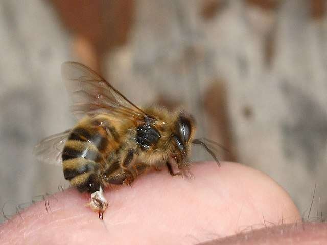 https://bestbees.com/bee-venom/